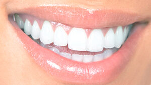 biologische-tandarts-friesland-mondhygiene-thumbnail